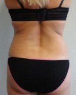 Exilis