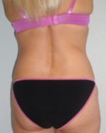 Exilis