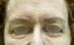 Exilis