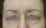 Exilis