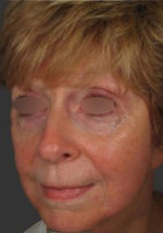 Exilis