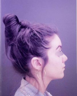 Nose Surgery