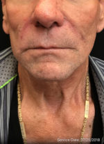 Face