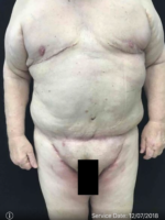 Body