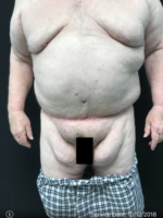 Body