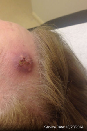 Facial Reconstruction