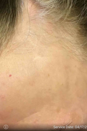 Facial Reconstruction