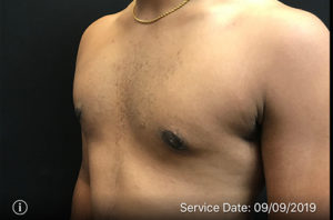 Body