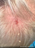 Dermatologic Surgery