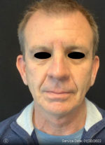 Face